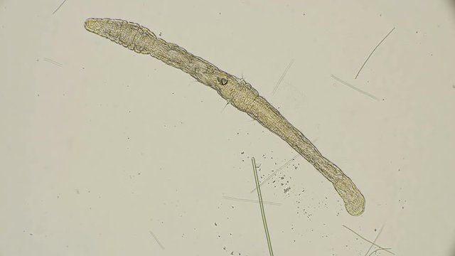 worm of the family Aeolosomatidae, Aeolosoma hemprichi, under the microscope