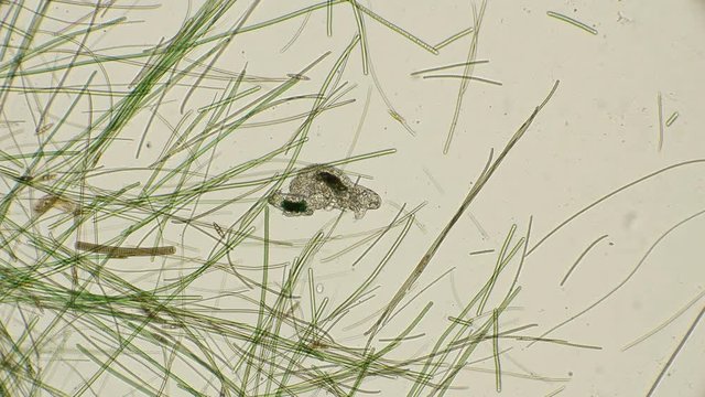 a large and small water bear Tardigrada, under a microscope
