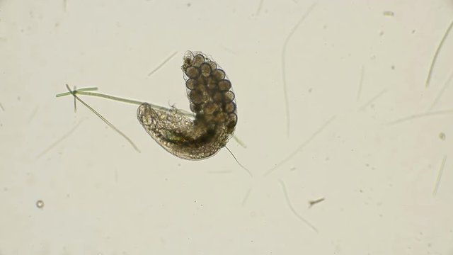 female bear Tardigrada with eggs under a microscope