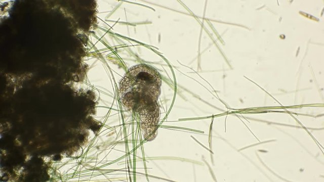 Mating of two silent Tardigrada, rare frames under a microscope
