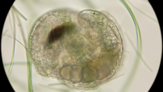 Mating of two silent Tardigrada, rare frames under a microscope
