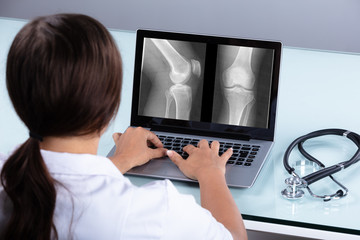 Doctor Examining Knee X-ray On Laptop