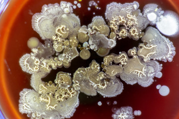 Mold growing in a Petri dish