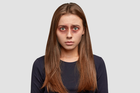 People and beat concept. Bruised dark haired young woman being victim of violent man, looks desperately at camera, dressed in black sweater, isolated over white background. Violence in family