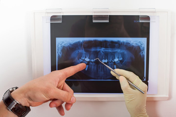 Dental x-ray
