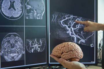 Brain model on doctor hand and MRI image