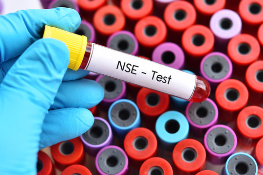 Blood Sample Tube For Neuron-Specific Enolase Or NSE Test, Tumor Marker For Lung Cancer
