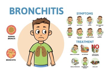 Bronchitis disease symptoms and treatment. Infographic poster with text and cartoon character. Flat vector illustration, horizontal.