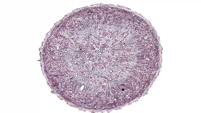 plasmodiophora brassicae root - cross section cut under the microscope &ndash; microscopic view of plant cells for botanic education