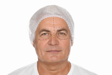 Portrait of senior man with marks on face preparing for cosmetic surgery against white background