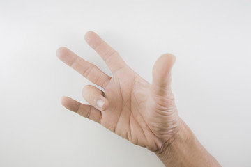 Trigger Finger a defect in a tendon causing a finger to jerk or snap straight when the hand is...