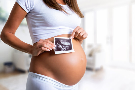 Nahaufnahme einer schwangeren Frau die eine Ultraschallaufnahme ihres Babys über dem Bauch hält