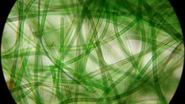 movement of live algae under a microscope