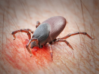 3d rendered illustration of a tick biting in human skin