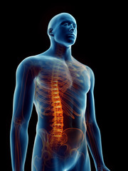 3d rendered medically accurate illustration of a mans painful spine