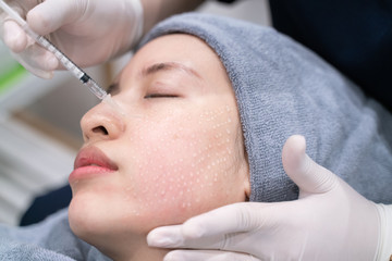 Needle mesotherapy in beauty clinic. Cosmetics injected to woman's face.