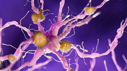 3d rendered medically accurate illustration of amyloid plaques on a alzheimer nerve cell