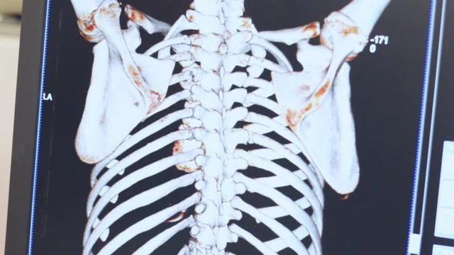 Magnetic resonance imaging of human skeleton on display. Professional radiography expertise and consultation in medical clinic. Computed tomography x-ray diagnostics. 3d mri scan of human rib cage