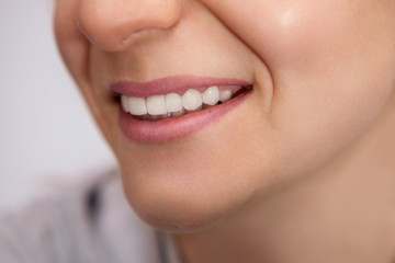 Healthy teeth of a smiled woman