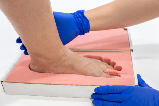 Female chiropodist, attending elder in a clinic and performing treatments podiatric, for the realization of insole for feet