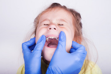Dental medicine and healthcare - dentist examining little child girl patient open mouth showing...