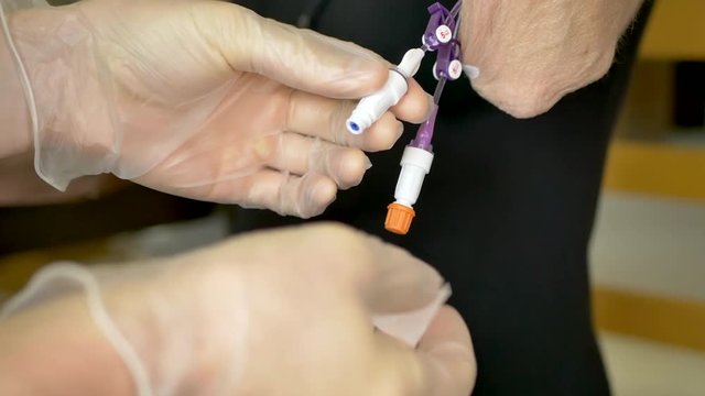 Medical nurse doing an at home iv patient visit wearing sterile gloves and setting up an antibiotic iv drip into an elderly woman's picc line.