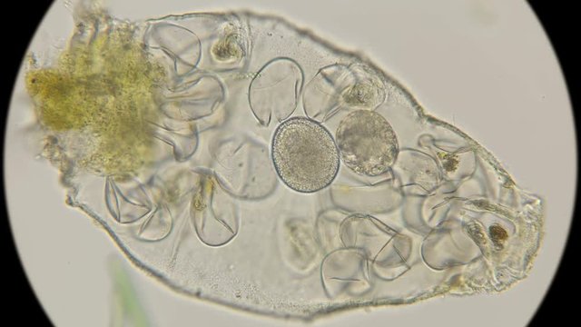 the remaining not hatched eggs with embryos at different stages of the slow-moving Tardigrada, in a bag of old skin