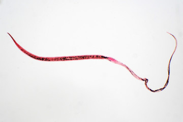 whipworm (Trichuris trichiura) is parasitic helminthic nematode (roundworm)