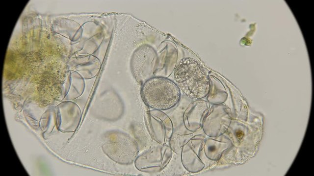 the remaining not hatched eggs with embryos at different stages of the slow-moving Tardigrada, in a bag of old skin