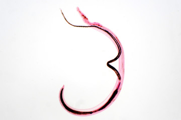 whipworm (Trichuris trichiura) is parasitic helminthic nematode (roundworm)