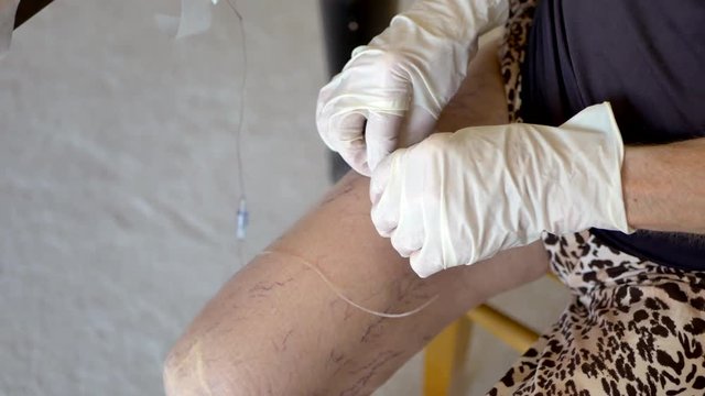 Middle aged woman medical patient with varicose veins inserting a small needle into her thigh during an at home antibiotic infusion treatment.