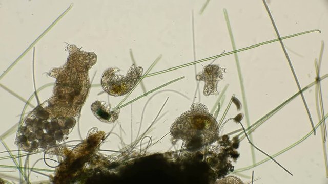 large family of water bears Tardigrada, female with eggs, males, cubs, under the microscope