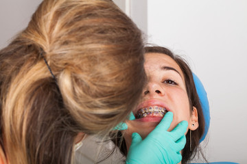 Dental braces close up