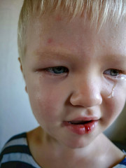 Unhappy little boy blond hurt his lip and crying with tears.