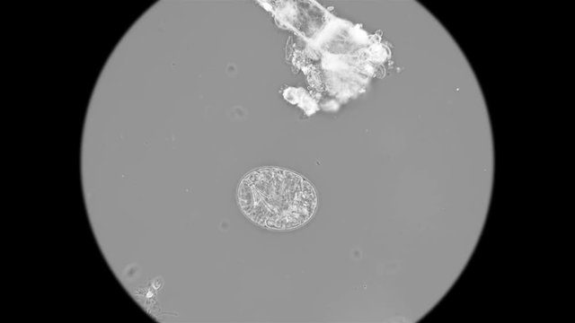 egg with a sambrion of the last stage of a slow-moving Tardigrada under a microscope