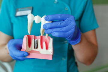 hands of the dentist hold a breadboard model of the tooth with an implant