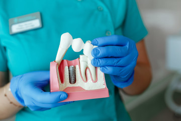 hands of the dentist hold a breadboard model of the tooth with an implant