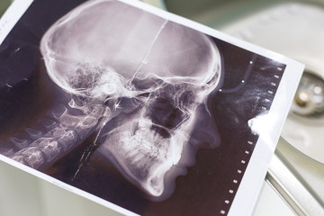 X-ray of head in the doctors office