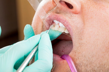 Dental treatment