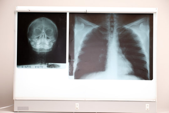 medical x-ray film