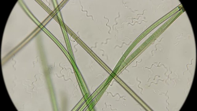 colony of bacteria spirochetes under a microscope