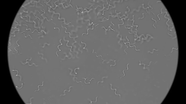 colony of bacteria spirochetes under a microscope
