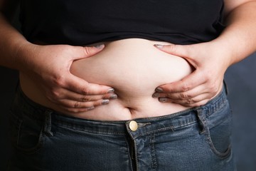 Overweight fat woman touching obese belly, closeup. Weight losing, obesity, health care concept