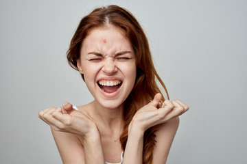 joyful woman eyes closed on face acne skin problem