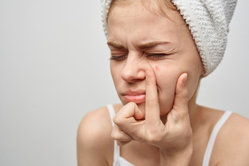 woman with a towel on her head squeezes acne on her face