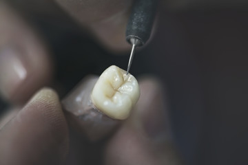 Artificial tooth being made