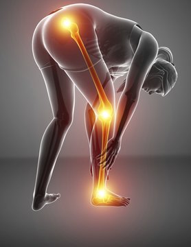 Woman With Leg Pain, Illustration