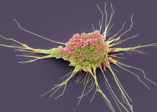 Dendritic cell, SEM