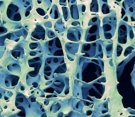 Bone tissue, SEM