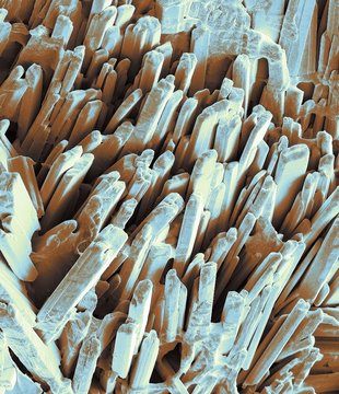 Gallstone crystals, SEM